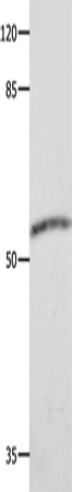 Rabbit Polyclonal Antibody to CAP2
