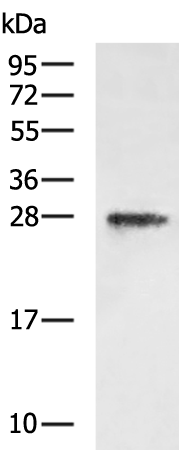 Rabbit Polyclonal Antibody to TNNI3