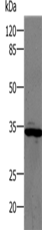 Rabbit Polyclonal Antibody to CA1
