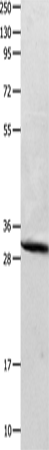 Rabbit Polyclonal Antibody to CA2