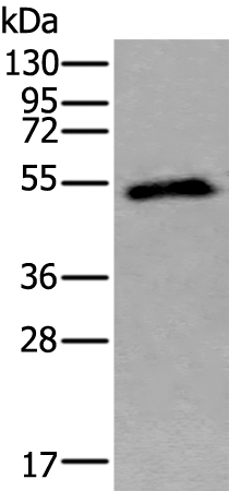 Rabbit Polyclonal Antibody to CA9