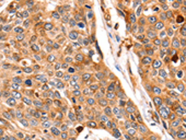 Rabbit Polyclonal Antibody to CTSB