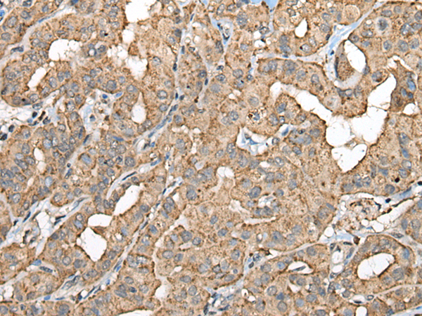 Rabbit Polyclonal Antibody to CTSD