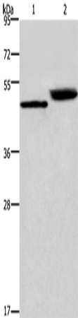 Rabbit Polyclonal Antibody to CTSE