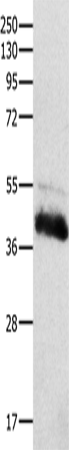 Rabbit Polyclonal Antibody to CTSH