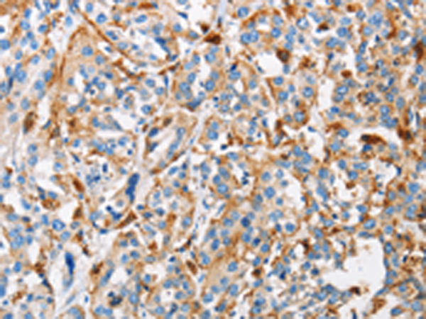 Rabbit Polyclonal Antibody to CTSL