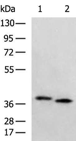 Rabbit Polyclonal Antibody to CTSV