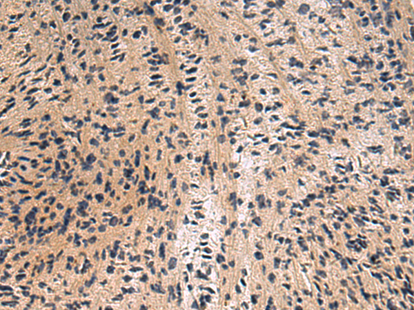 Rabbit Polyclonal Antibody to CTSZ