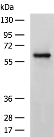 Rabbit Polyclonal Antibody to CBX2