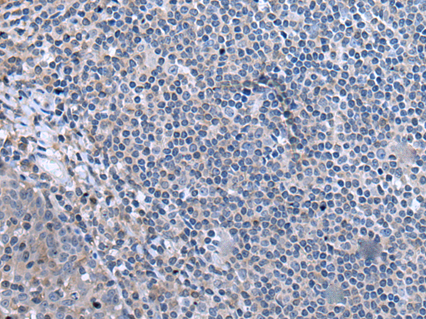 Rabbit Polyclonal Antibody to CCK