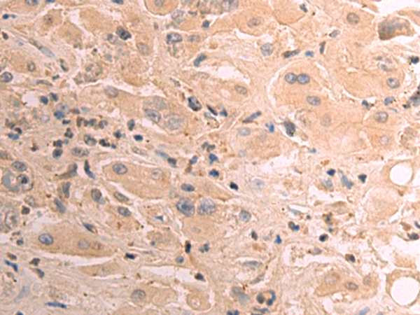 Rabbit Polyclonal Antibody to CCL21