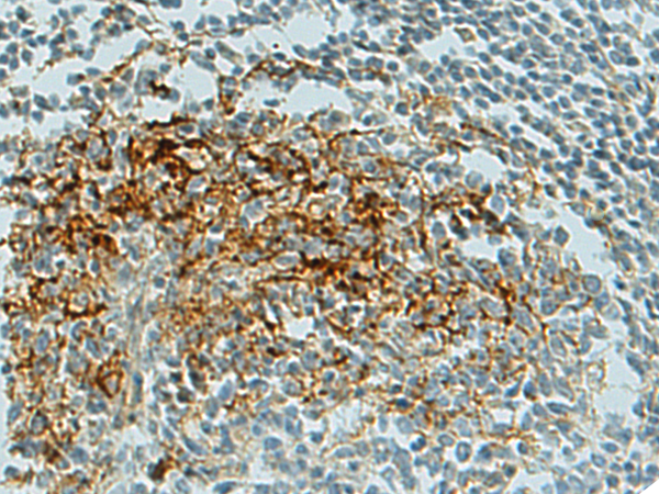 Rabbit Polyclonal Antibody to CLEC7A