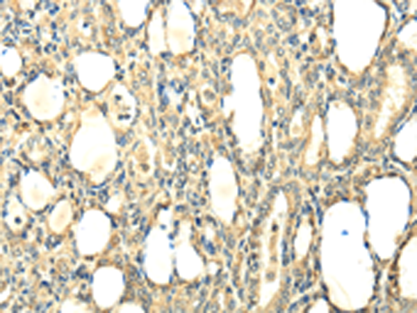 Rabbit Polyclonal Antibody to CCL25