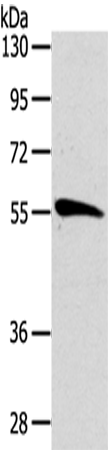 Rabbit Polyclonal Antibody to CDC25A