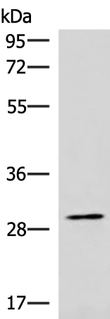 Rabbit Polyclonal Antibody to CDK4