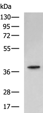 Rabbit Polyclonal Antibody to CDK6