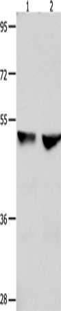 Rabbit Polyclonal Antibody to CDK9