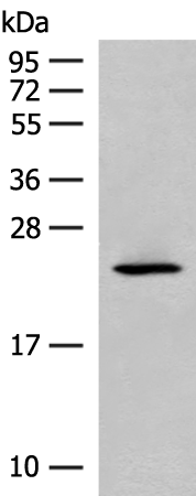 Rabbit Polyclonal Antibody to CDKN1A