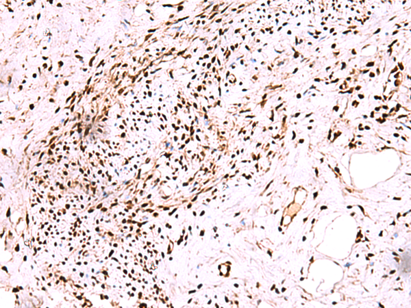Rabbit Polyclonal Antibody to CDKN1B