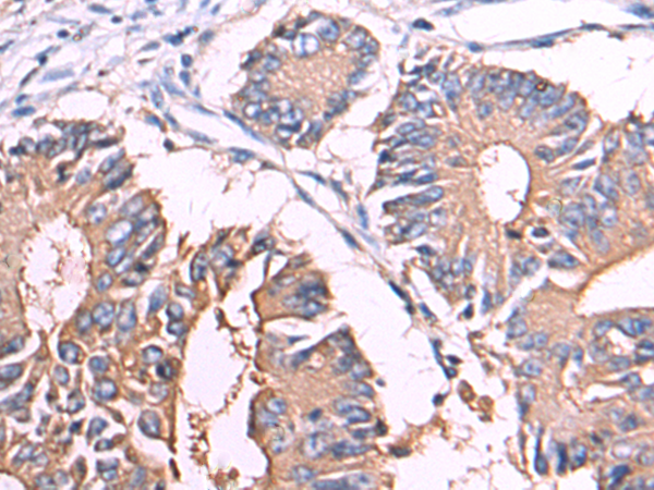 Rabbit Polyclonal Antibody to CEACAM8