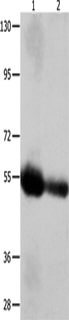 Rabbit Polyclonal Antibody to CEACAM1