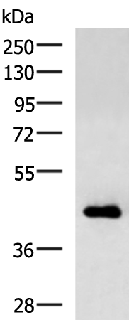 Rabbit Polyclonal Antibody to CHI3L1