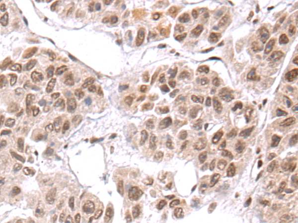 Rabbit Polyclonal Antibody to CEBPG