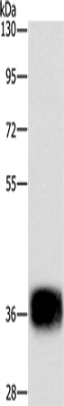 Rabbit Polyclonal Antibody to CEBPE