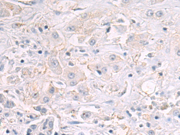 Rabbit Polyclonal Antibody to ERBB3