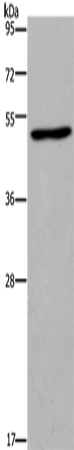 Rabbit Polyclonal Antibody to FOS
