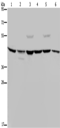 Rabbit Polyclonal Antibody to CSNK2A1