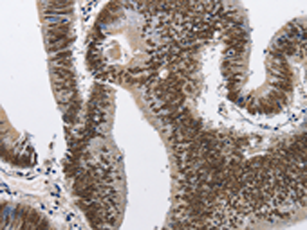 Rabbit Polyclonal Antibody to CMTM2