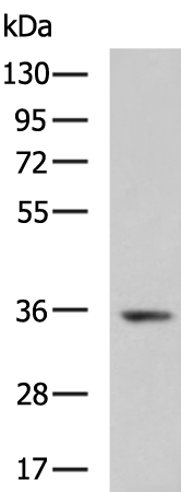 Rabbit Polyclonal Antibody to CLEC1A