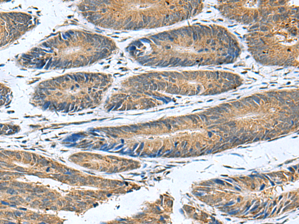Rabbit Polyclonal Antibody to CLEC1B