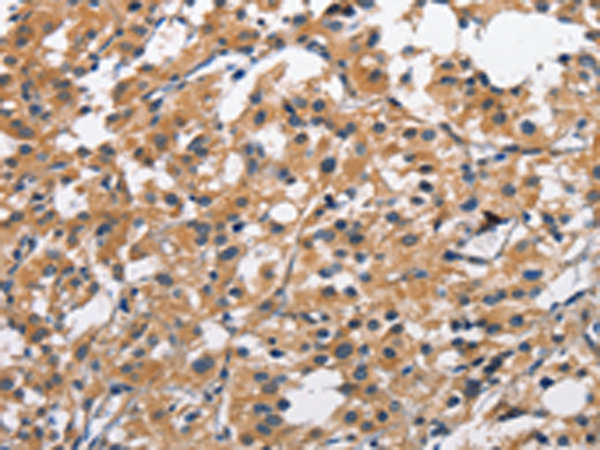 Rabbit Polyclonal Antibody to CLEC2D