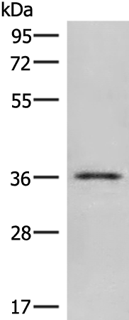 Rabbit Polyclonal Antibody to CLEC10A