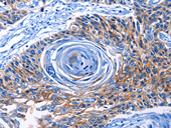 Rabbit Polyclonal Antibody to CLEC2B