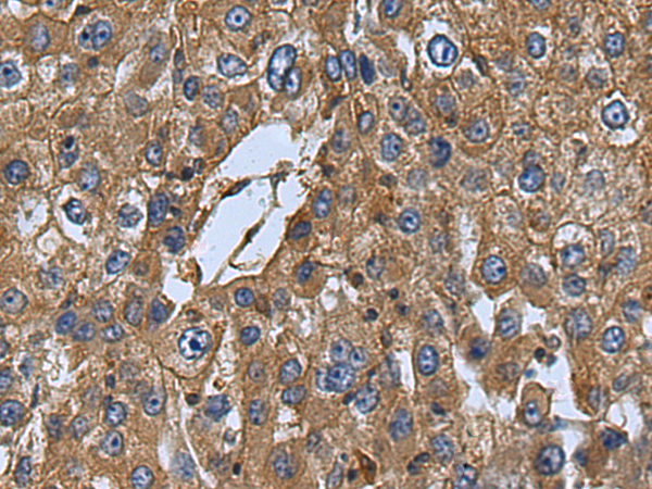Rabbit Polyclonal Antibody to MERTK