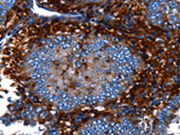 Rabbit Polyclonal Antibody to CNGA2