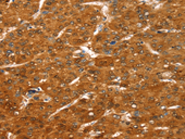 Rabbit Polyclonal Antibody to COLEC11