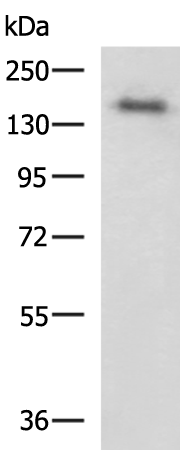 Rabbit Polyclonal Antibody to COL2A1