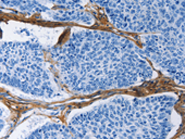 Rabbit Polyclonal Antibody to COL3A1