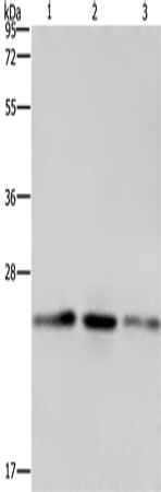 Rabbit Polyclonal Antibody to EMC8