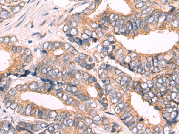 Rabbit Polyclonal Antibody to COX7A2L