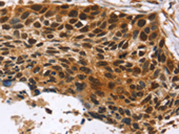 Rabbit Polyclonal Antibody to CDX1