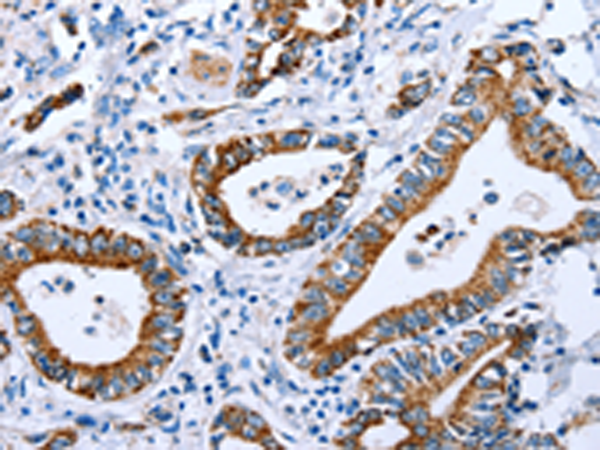 Rabbit Polyclonal Antibody to CPT1A