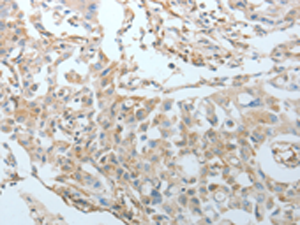 Rabbit Polyclonal Antibody to CRMP1