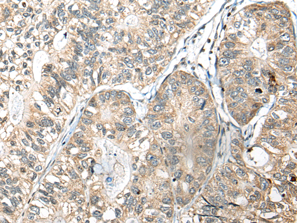 Rabbit Polyclonal Antibody to SLAMF7
