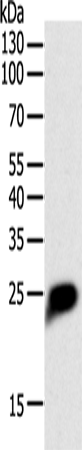 Rabbit Polyclonal Antibody to CRP