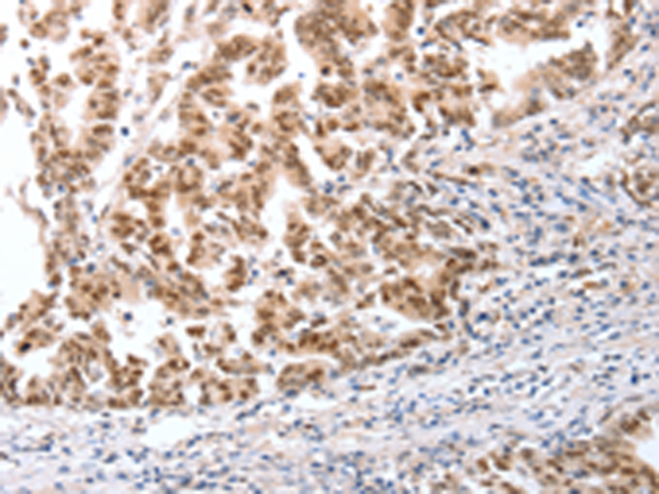 Rabbit Polyclonal Antibody to CTBP2